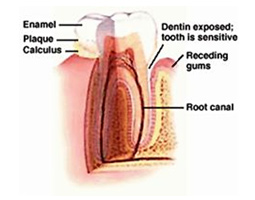 Sensitive Teeth